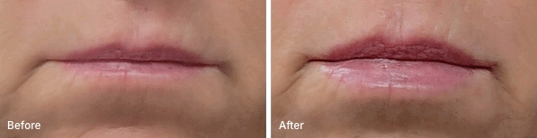 Before and After Photos